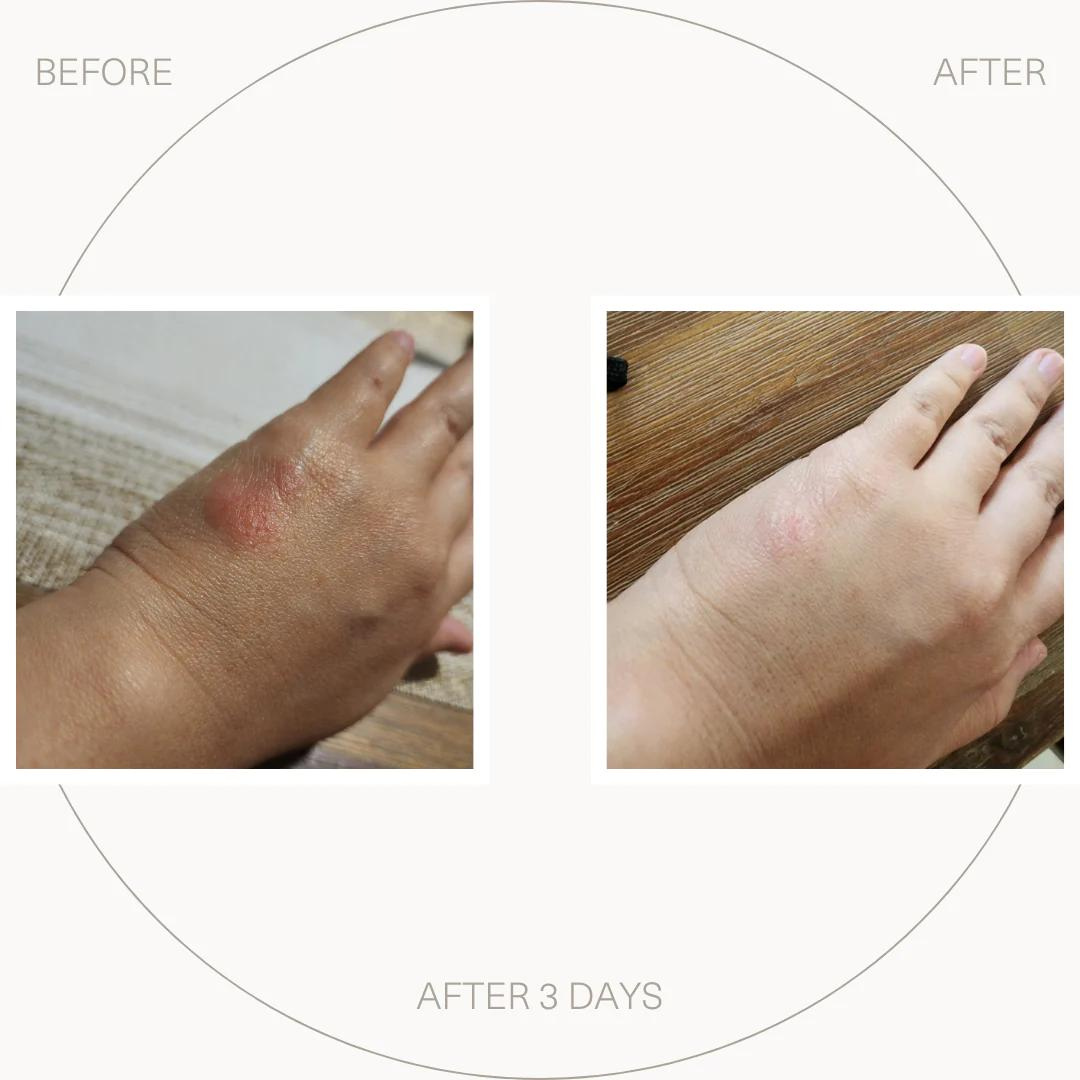 UltraSensitive Skin Rescue Lotion 100ml