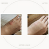 UltraSensitive Skin Rescue Lotion 100ml
