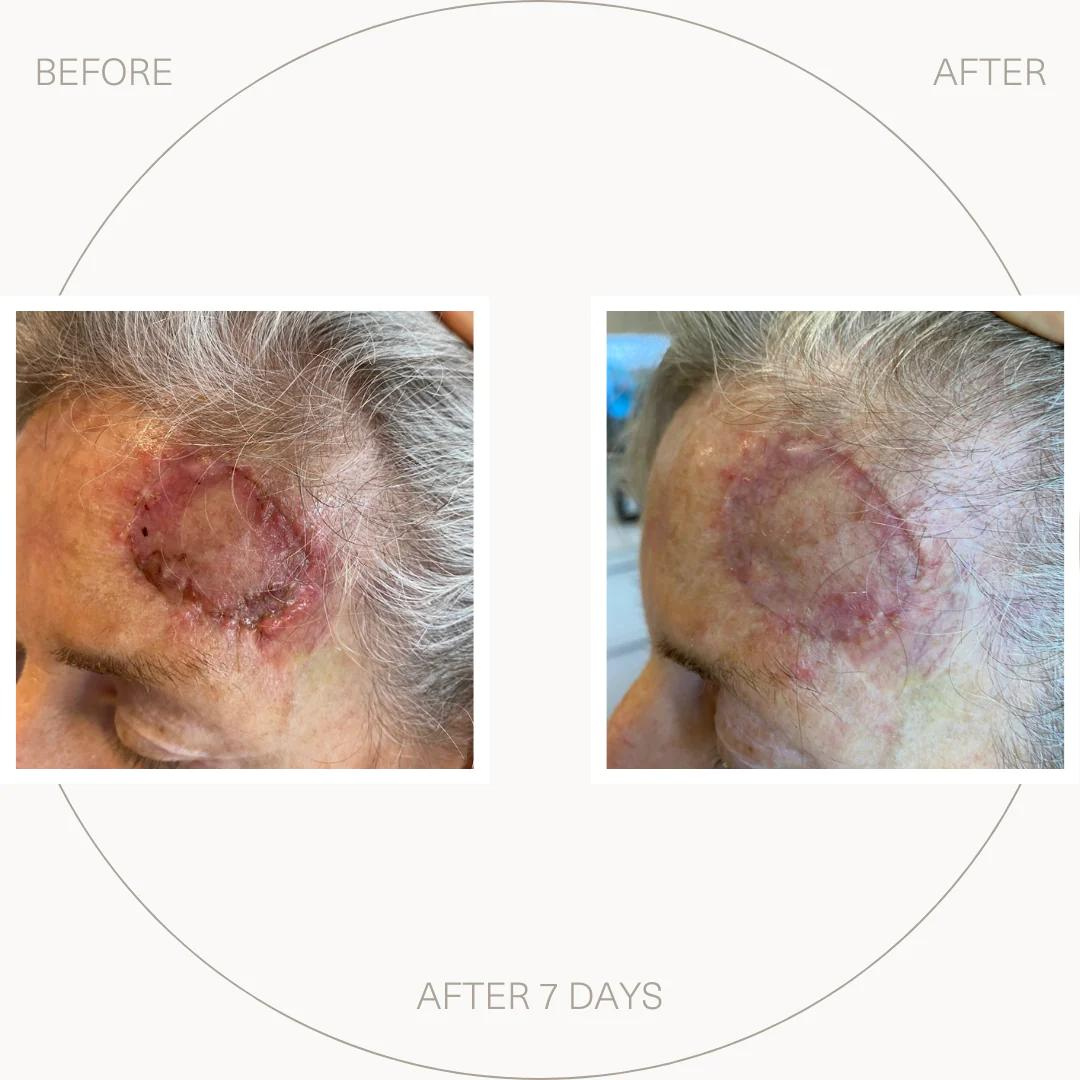 'Self Heal' Salve 30ml