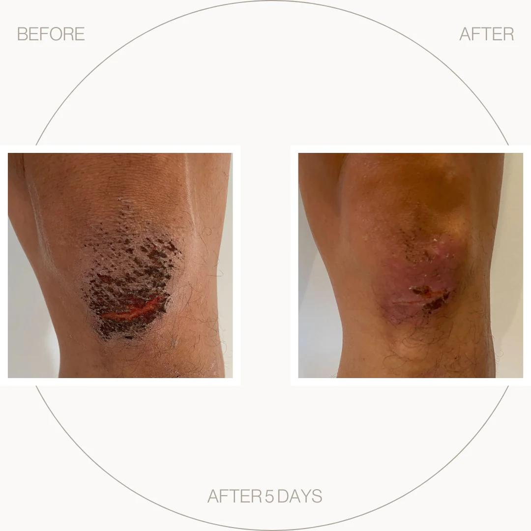 'Self Heal' Salve 30ml