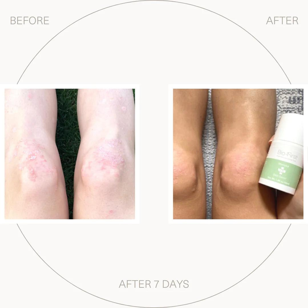 Manuka Skin Saver 50ml
