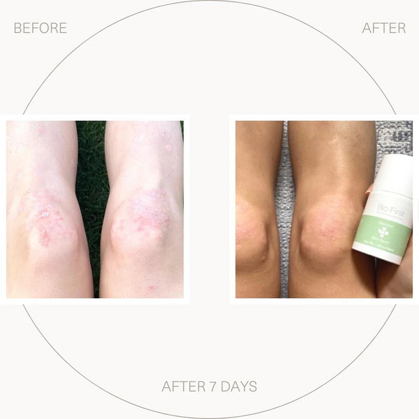 Manuka Skin Saver 50ml