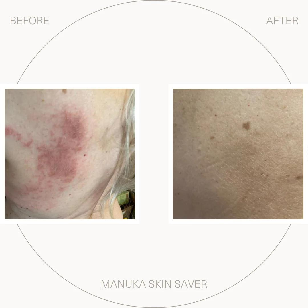 Manuka Skin Saver 50ml
