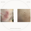 Manuka Skin Saver 50ml
